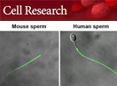 Discovery of a water channel essential for postcopulatory sperm osmoadaptation