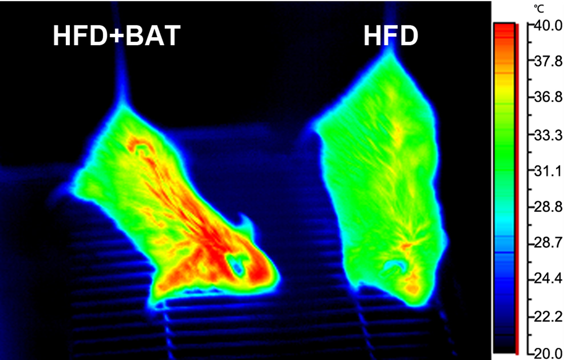 Brown adipose tissue transplantation improves whole-body energy metabolism