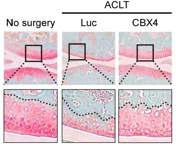 Rejuvenation of Aging Cells Helps to Cure Osteoarthritis Through Gene Therapy