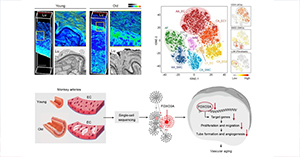 Researchers Provide Novel Insights into Primate Arterial Aging