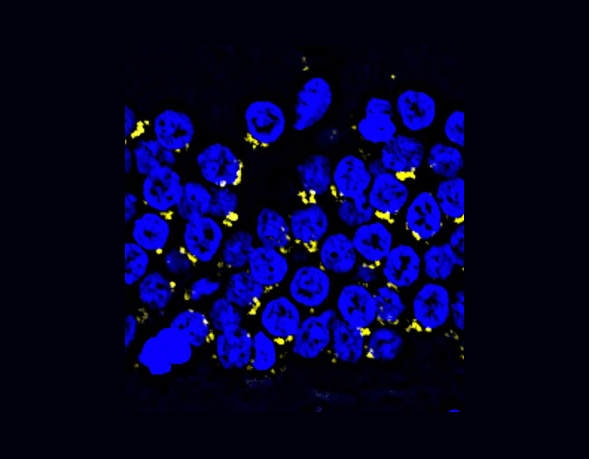 Tick tock in the brain: Scientists provide molecular insights into primate hippocampal aging