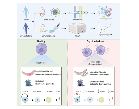Deciphering the Pathological Mechanisms of Spermatogenic Impairment in Cryptorchidism