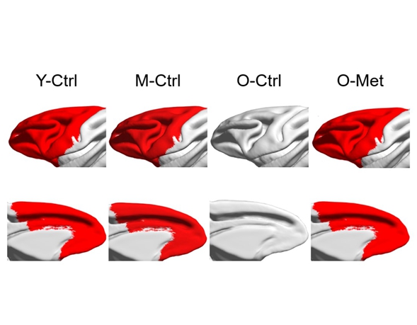 Chinese Scientists Uncover Metformin′s Potential to Delay Aging in Primates