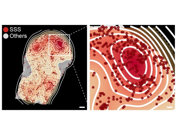 Unveiling the Secrets of Aging: Chinese Scientists Discover the Dual Role of Immunoglobulins