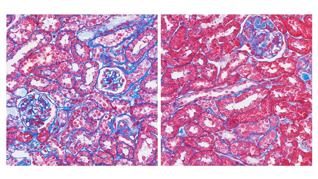 Scientists Decode Exercise’s Anti-Aging Secret: Kidney Molecule Mimics Workout Benefits