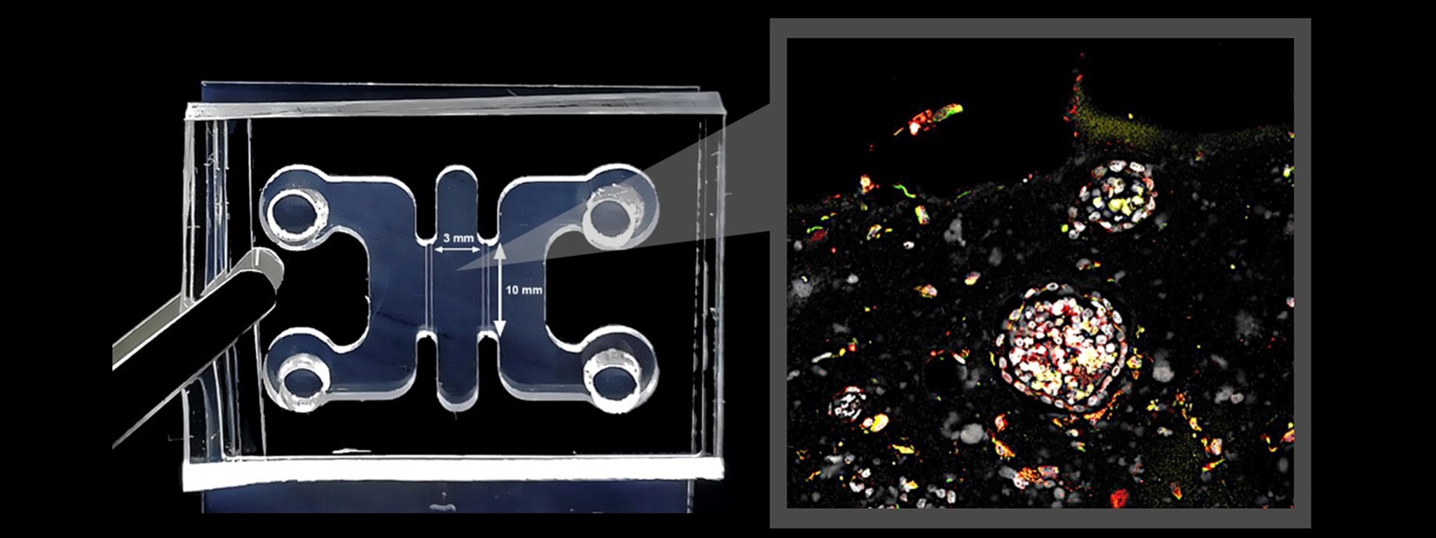 3D Uterine Embryo Implantation Simulating Chip Cracks the Code of Repeated Implantation Failure