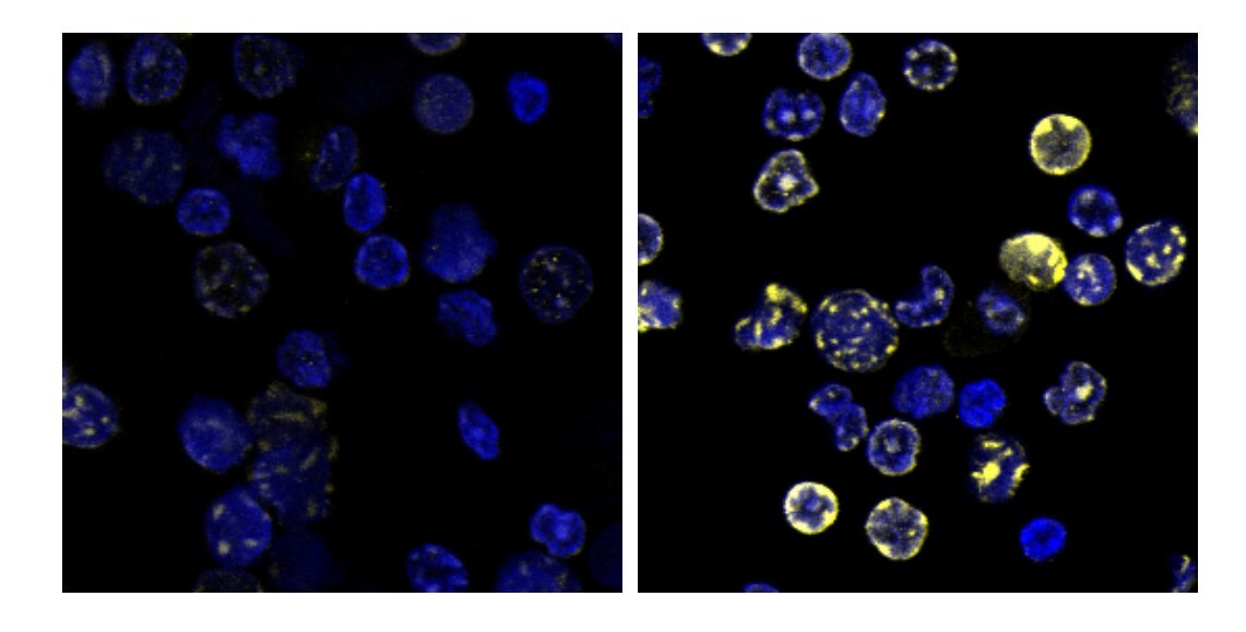 Vitamin C Turns Back the Clock on Aging Bone Marrow in Primates